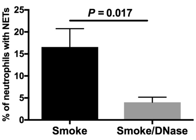The addition of DNase 1 reduces the expression of cigarette smoke-induced NETs.jpg